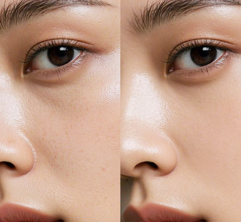 Before and After Image